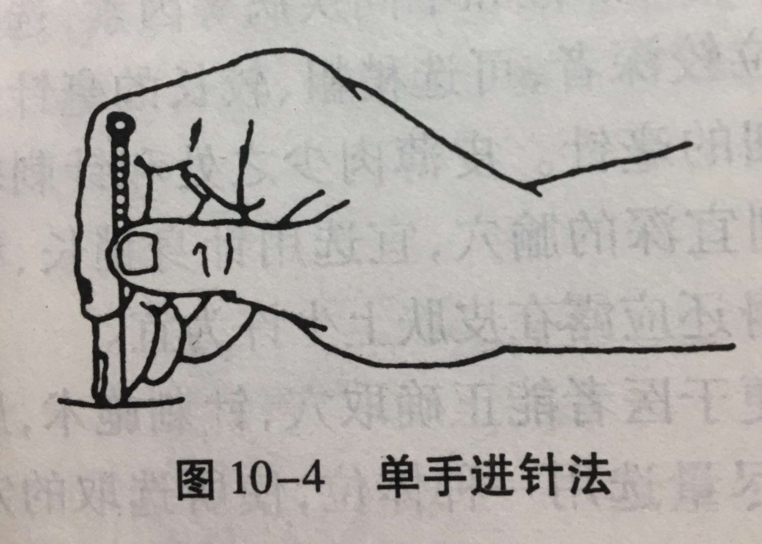 【三,毫针刺法】