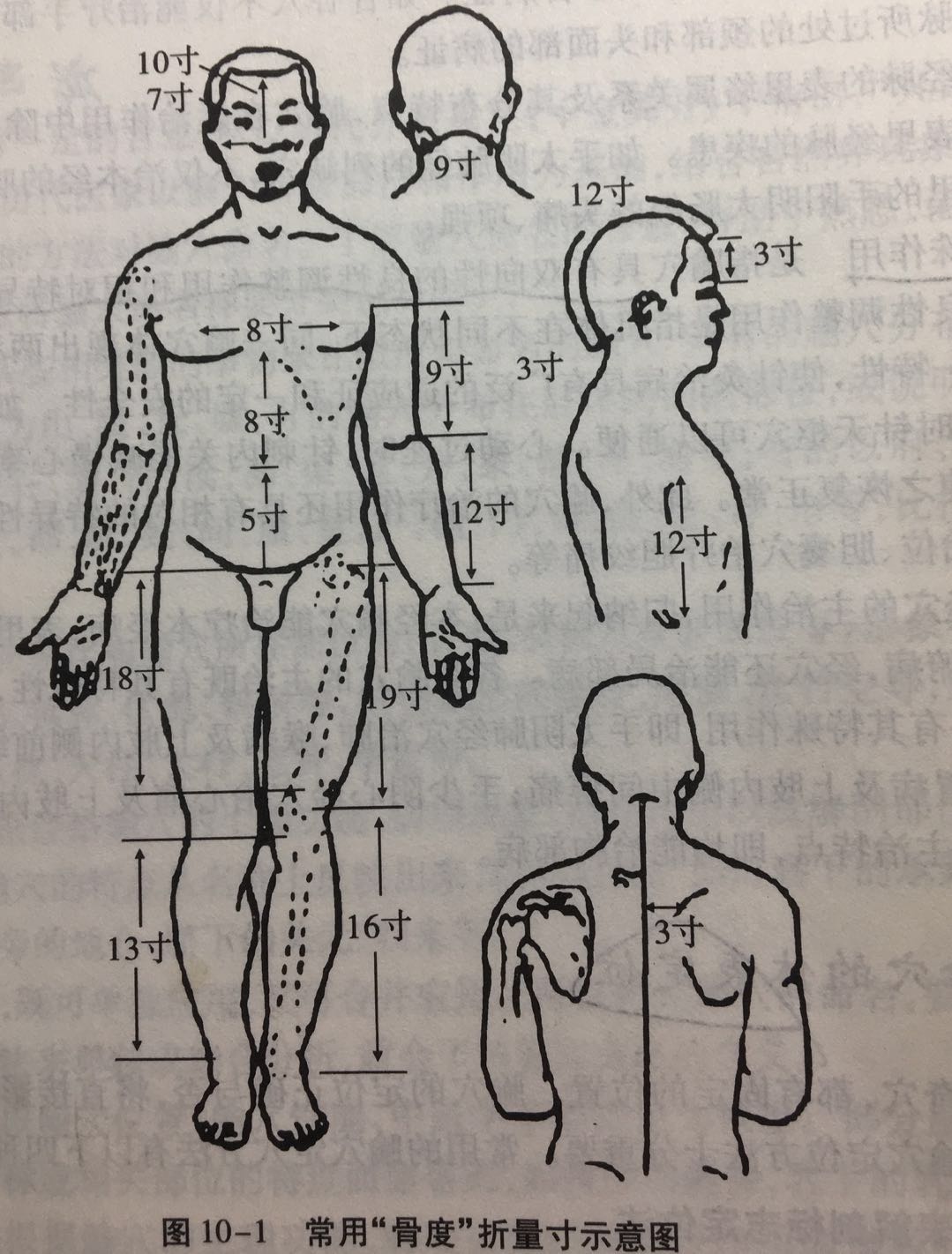 中医学 10 针灸