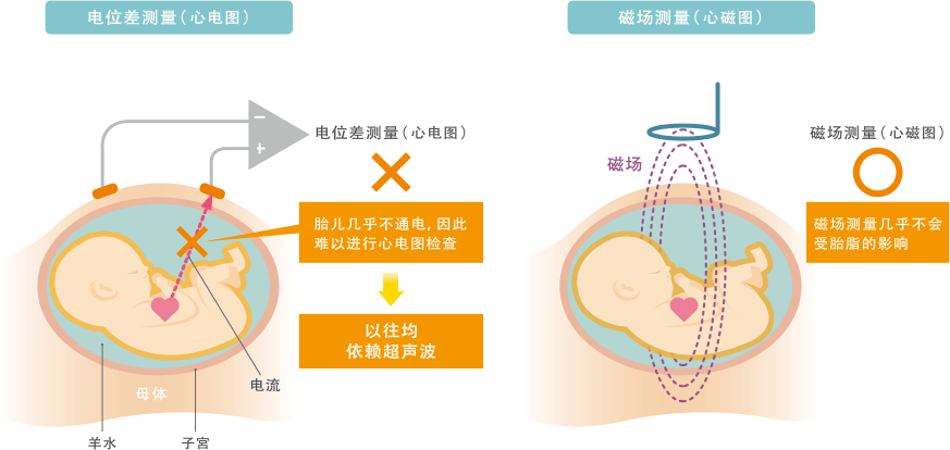 图8 通过使用MR磁性传感器的心磁图仪测量胎儿的心磁场(示意图)