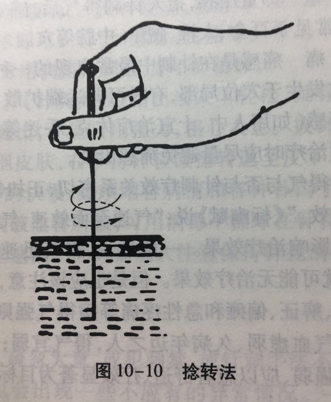 【中医学】10 针灸-1-CSDN博客